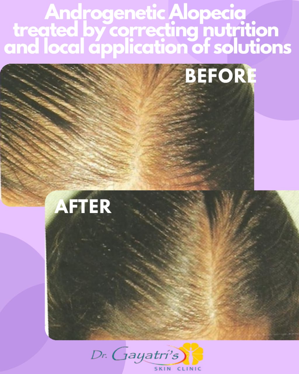 Dr Gayatris skin clinic, Dermatologist in 1st Floor, 3 Bhagyoday